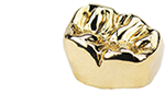 55% Gold Crown photo